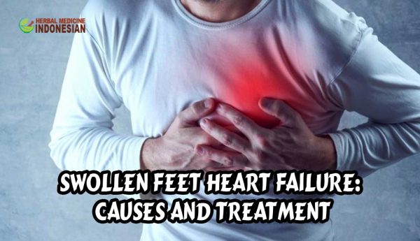 Swollen Feet Heart Failure: Causes and Treatment | PT. Ben Sehat Sejahtera