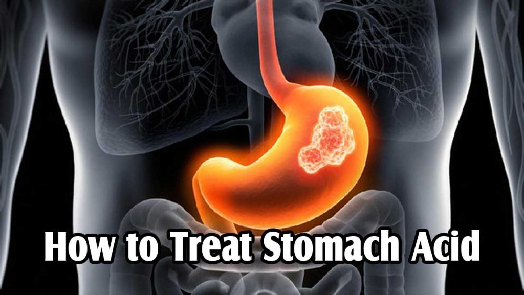 how-to-treat-stomach-acid-herb-medicine-indonesia